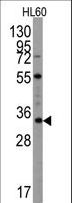 UBTD1 Antibody - Western blot of UBTD1 Antibody (C-term G195) in Hl60 cell line lysates (35 ug/lane). UBTD1(arrow) was detected using the purified antibody.