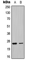 UBTD1 Antibody - Western blot analysis of UBTD1 expression in HepG2 (A); K562 (B) whole cell lysates.
