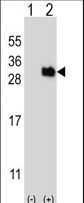 UBTD1 Antibody - Western blot of UBTD1 (arrow) using rabbit polyclonal UBTD1 Antibody. 293 cell lysates (2 ug/lane) either nontransfected (Lane 1) or transiently transfected (Lane 2) with the UBTD1 gene.