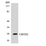 UBTD2 Antibody - Western blot analysis of the lysates from HUVECcells using UBTD2 antibody.