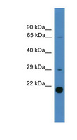 UBTD2 Antibody - UBTD2 antibody Western blot of Fetal Liver lysate. This image was taken for the unconjugated form of this product. Other forms have not been tested.