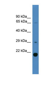 UBTD2 Antibody - UBTD2 antibody Western blot of Fetal Liver lysate. This image was taken for the unconjugated form of this product. Other forms have not been tested.