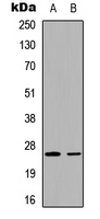 UBTD2 Antibody - Western blot analysis of UBTD2 expression in HEK293T (A); rat kidney (B) whole cell lysates.