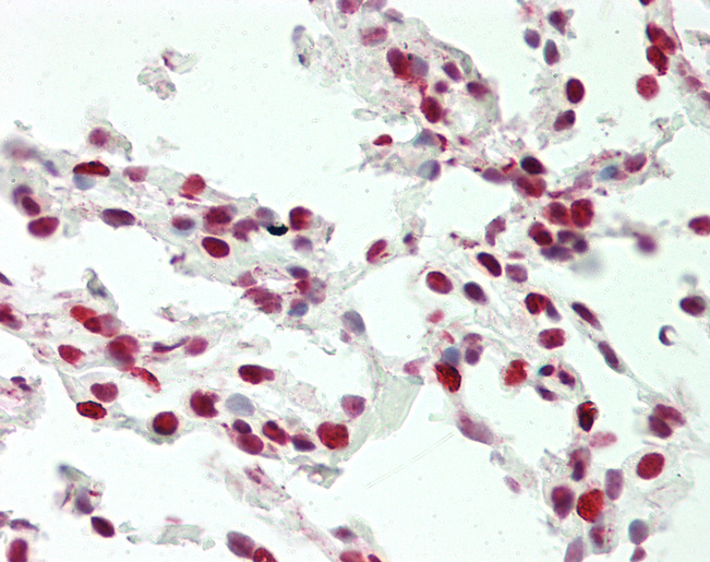 UBTF / UBF Antibody - Human Lung: Formalin-Fixed, Paraffin-Embedded (FFPE).  This image was taken for the unconjugated form of this product. Other forms have not been tested.