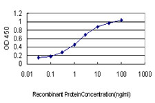 UBTF / UBF Antibody - Detection limit for recombinant GST tagged UBTF is approximately 0.03 ng/ml as a capture antibody.