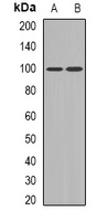 UBTF / UBF Antibody - Western blot analysis of UBF expression in Jurkat (A); rat muscle (B) whole cell lysates.