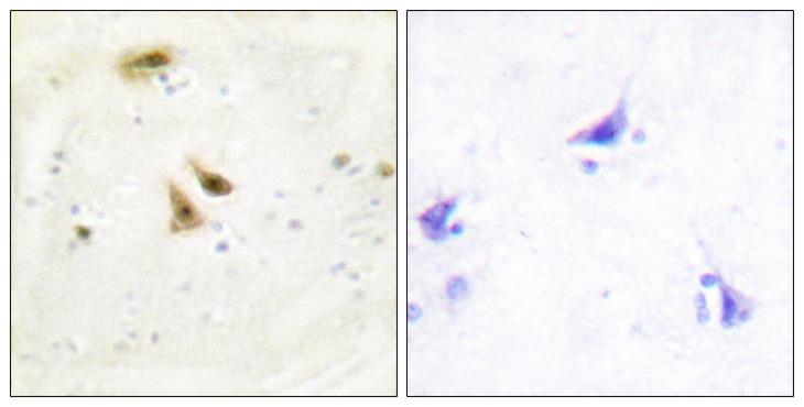 UBTF / UBF Antibody - Western blot analysis of extracts from HeLa cells and Jurkat cells, using UBF1 antibody.