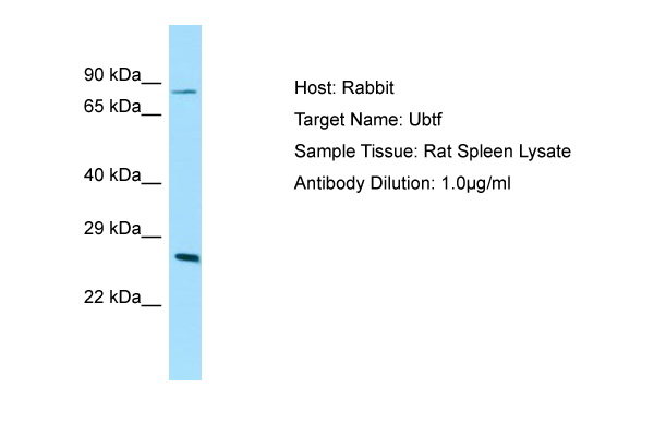 UBTF / UBF Antibody -  This image was taken for the unconjugated form of this product. Other forms have not been tested.