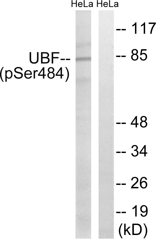 UBTF / UBF Antibody - Western blot analysis of lysates from HeLa cells treated with calyculinA 50ng/ml 30', using UBF (Phospho-Ser484) Antibody. The lane on the right is blocked with the phospho peptide.
