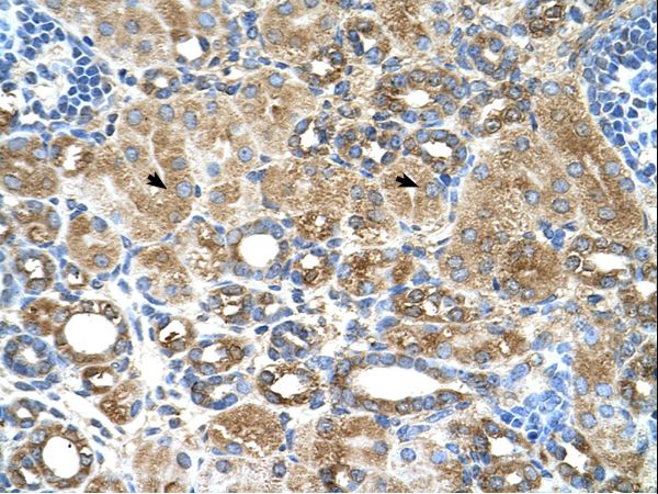 UBXD2 / UBXN4 Antibody - UBXN4 / UBXD2 antibody UBXD2(UBX domain containing 2) Antibody was used in IHC to stain formalin-fixed, paraffin-embedded human kidney.  This image was taken for the unconjugated form of this product. Other forms have not been tested.