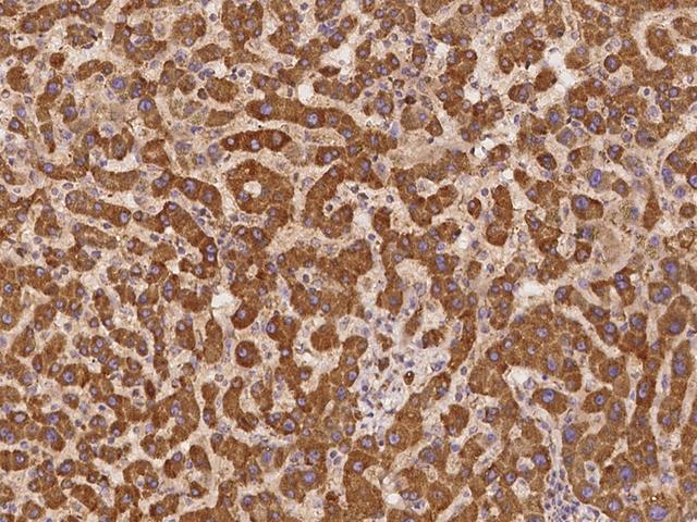 UBXD2 / UBXN4 Antibody - Immunochemical staining of human UBXN4 in human liver with rabbit polyclonal antibody at 1:100 dilution, formalin-fixed paraffin embedded sections.
