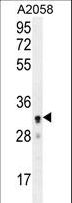 UBXD4 / UBXN2A Antibody - UBXN2A Antibody western blot of A2058 cell line lysates (35 ug/lane). The UBXN2A antibody detected the UBXN2A protein (arrow).