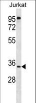 UBXD6 Antibody - UBXN8 Antibody western blot of Jurkat cell line lysates (35 ug/lane). The UBXN8 antibody detected the UBXN8 protein (arrow).