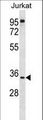 UBXD6 Antibody - UBXN8 Antibody western blot of Jurkat cell line lysates (35 ug/lane). The UBXN8 antibody detected the UBXN8 protein (arrow).