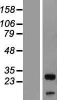 UBXD6 Protein - Western validation with an anti-DDK antibody * L: Control HEK293 lysate R: Over-expression lysate