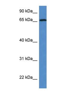 UBXD9 / ASPL Antibody - ASPSCR1 antibody Western blot of Fetal Lung lysate. Antibody concentration 1 ug/ml.  This image was taken for the unconjugated form of this product. Other forms have not been tested.