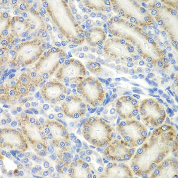 UBXD9 / ASPL Antibody - Immunohistochemistry of paraffin-embedded rat kidney tissue.