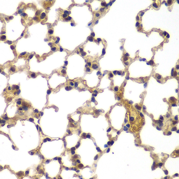 UBXD9 / ASPL Antibody - Immunohistochemistry of paraffin-embedded mouse lung tissue.