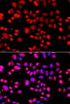 UBXD9 / ASPL Antibody - Immunofluorescence analysis of A549 cells.