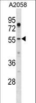 UBXD9 / ASPL Antibody - ASPSCR1 Antibody western blot of A2058 cell line lysates (35 ug/lane). The ASPSCR1 antibody detected the ASPSCR1 protein (arrow).