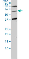 UBXD9 / ASPL Antibody - ASPSCR1 monoclonal antibody (M01), clone 3D10-1D11 Western blot of ASPSCR1 expression in HeLa NE.