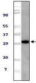UBXD9 / ASPL Antibody - Tug Antibody in Western Blot (WB)