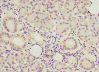 UBXD9 / ASPL Antibody - Immunohistochemistry of paraffin-embedded human pancreatic tissue at dilution 1:100