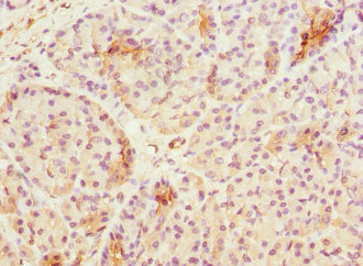 UBXD9 / ASPL Antibody - Immunohistochemistry of paraffin-embedded human pancreatic tissue at dilution 1:100
