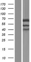 UBXD9 / ASPL Protein - Western validation with an anti-DDK antibody * L: Control HEK293 lysate R: Over-expression lysate
