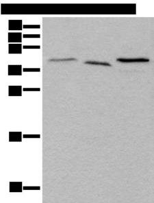 UBXN1 Antibody - Western blot analysis of Mouse brain tissue Hela and HEPG2 cell lysates  using UBXN1 Polyclonal Antibody at dilution of 1:500