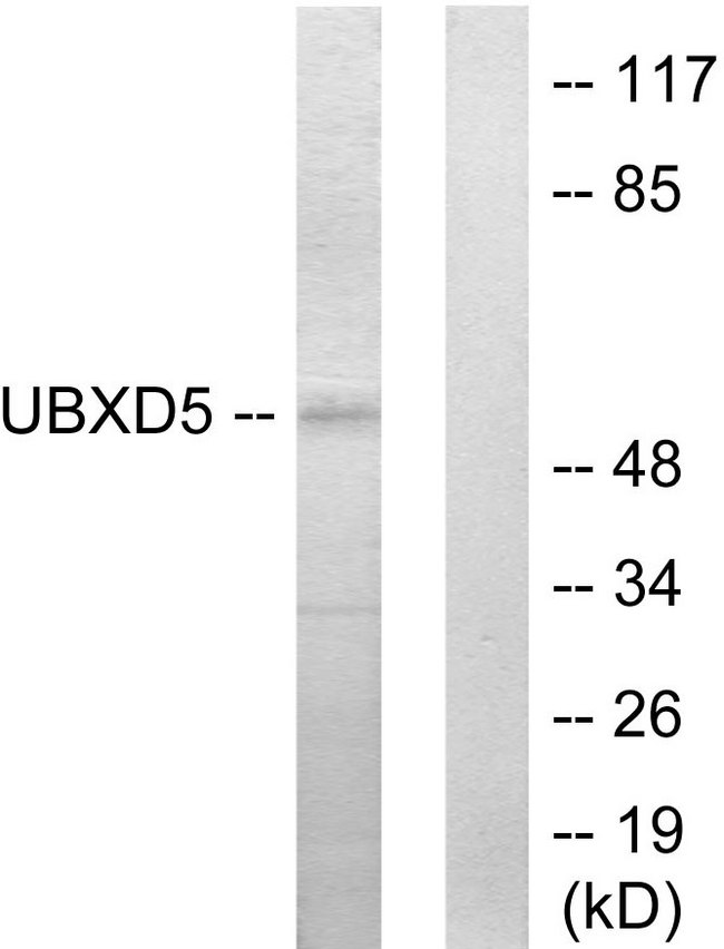 UBXN11 / SOC Antibody - Western blot analysis of lysates from HepG2 cells, using UBXD5 Antibody. The lane on the right is blocked with the synthesized peptide.