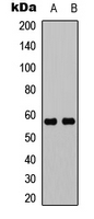 UBXN11 / SOC Antibody - Western blot analysis of UBXN11 expression in K562 (A); mouse brain (B) whole cell lysates.