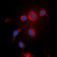UBXN11 / SOC Antibody - Immunofluorescent analysis of UBXN11 staining in K562 cells. Formalin-fixed cells were permeabilized with 0.1% Triton X-100 in TBS for 5-10 minutes and blocked with 3% BSA-PBS for 30 minutes at room temperature. Cells were probed with the primary antibody in 3% BSA-PBS and incubated overnight at 4 deg C in a humidified chamber. Cells were washed with PBST and incubated with a DyLight 594-conjugated secondary antibody (red) in PBS at room temperature in the dark. DAPI was used to stain the cell nuclei (blue).