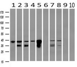 UBXN2B Antibody - Western blot of extracts (10ug) from 10 Human tissue by using anti-UBXN2B monoclonal antibody at 1:200 (1: Testis; 2: Omentum; 3: Uterus; 4: Breast; 5: Brain; 6: Liver; 7: Ovary; 8: Thyroid gland; 9: colon;10: spleen).