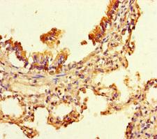 UBXN2B Antibody - Immunohistochemistry of paraffin-embedded human lung tissue using UBXN2B Antibody at dilution of 1:100