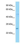UBXN6 / UBXD1 Antibody - UBXN6 / UBXD1 antibody Western Blot of Mouse Heart.  This image was taken for the unconjugated form of this product. Other forms have not been tested.