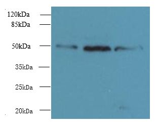 UBXN6 / UBXD1 Antibody - Western blot. All lanes: UBXN6 antibody at 1.2 ug/ml. Lane 1: PC-3 whole cell lysate. Lane 2: HeLa whole cell lysate. Lane 3: Mouse kidney tissue. Secondary antibody: Goat polyclonal to Rabbit IgG at 1:10000 dilution. Predicted band size: 50 kDa. Observed band size: 50 kDa.