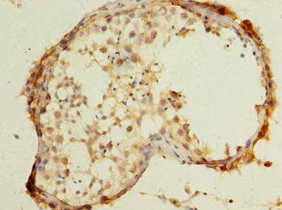 UBXN6 / UBXD1 Antibody - Immunohistochemistry of paraffin-embedded human testis tissue using antibody at dilution of 1:100.