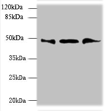 UBXN6 / UBXD1 Antibody - Western blot All lanes: UBXN6 antibody at 1.2µg/ml Lane 1: PC-3 whole cell lysate Lane 2: Hela whole cell lysate Lane 3: Mouse kidney tissue Secondary Goat polyclonal to rabbit IgG at 1/10000 dilution Predicted band size: 50, 44 kDa Observed band size: 50 kDa