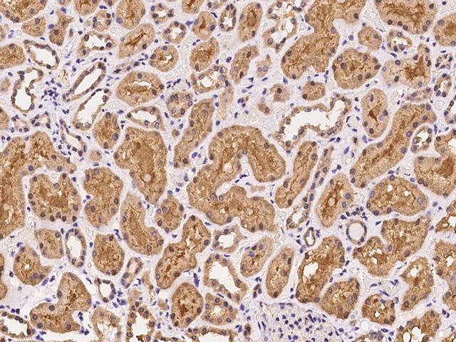 UBXN6 / UBXD1 Antibody - Immunochemical staining of human UBXN6 in human kidney with rabbit polyclonal antibody at 1:100 dilution, formalin-fixed paraffin embedded sections.