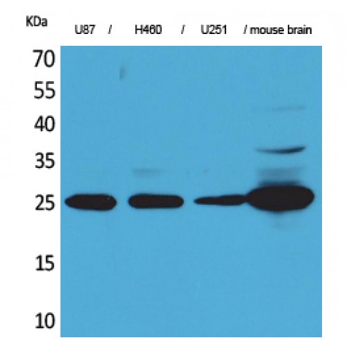UCHL1 / PGP9.5 Antibody - Western blot of UCH-L1 antibody