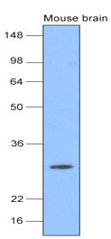 UCHL1 / PGP9.5 Antibody - The extracts of mouse brain (20 ug) were resolved by SDS-PAGE, transferred to NC membrane and probed with anti-human PGP9.5(1:1000). Proteins were visualized using a goat anti-mouse secondary antibody conjugated to HRP and an ECL detection system.