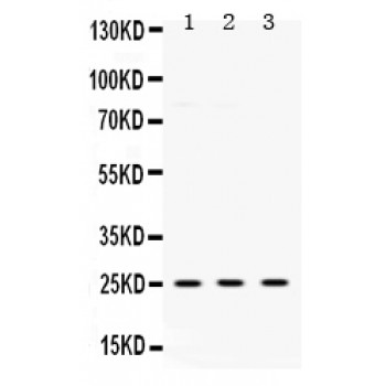 UCHL1 / PGP9.5 Antibody - PGP9.5 antibody Western blot. All lanes: Anti PGP9.5 at 0.5 ug/ml. Lane 1: Rat Brain Tissue Lysate at 50 ug. Lane 2: Mouse Brain Tissue Lysate at 50 ug. Lane 3: U87 Whole Cell Lysate at 40 ug. Predicted band size: 25 kD. Observed band size: 25 kD.