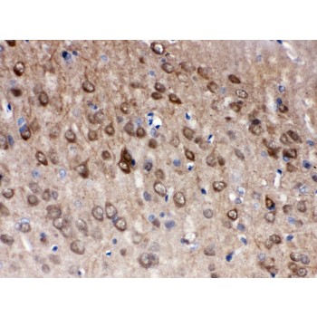 UCHL1 / PGP9.5 Antibody - PGP9.5 antibody IHC-paraffin. IHC(P): Rat Brain Tissue.