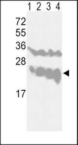 UCHL1 / PGP9.5 Antibody - Western blot of UCHL1-V31 in CEM(lane 1), Jurkat(lane 2), Y79(lane 3) cell line and mouse brain tissue(lane 4) lysates (35 ug/lane). UCHL1 (arrow) was detected using the purified antibody.
