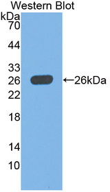 UCHL1 / PGP9.5 Antibody
