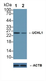 UCHL1 / PGP9.5 Antibody - Knockout Varification: Lane 1: Wild-type A549 cell lysate; Lane 2: UCHL1 knockout A549 cell lysate; Predicted MW: 25kd Observed MW: 26kd Primary Ab: 1µg/ml Rabbit Anti-Rat UCHL1 Antibody Second Ab: 0.2µg/mL HRP-Linked Caprine Anti-Rabbit IgG Polyclonal Antibody