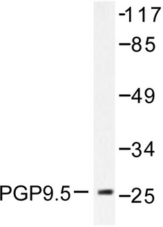 UCHL1 / PGP9.5 Antibody - Western blot of PGP9.5 (R202) pAb in extracts from 293 cells.