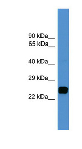 UCHL1 / PGP9.5 Antibody - UCHL1 / PGP9.5 antibody Western blot of Fetal Brain lysate. This image was taken for the unconjugated form of this product. Other forms have not been tested.