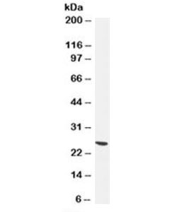 UCHL1 / PGP9.5 Antibody - Western blot testing of human brain lysate with UchL1 antibody (clone 13C4). Predicted molecular weight ~25kDa. This image was taken for the unmodified form of this product. Other forms have not been tested.